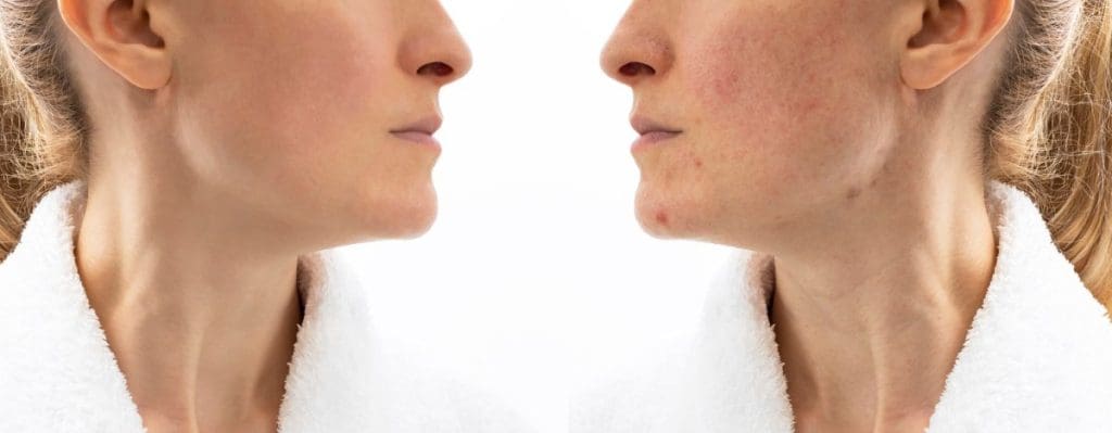 Discover the best probiotics for skin and gut health + top probiotics for skin health