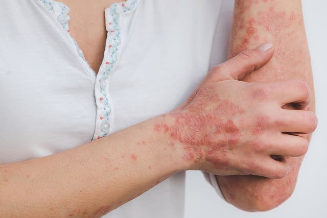 10 signs of an unhealthy gut
