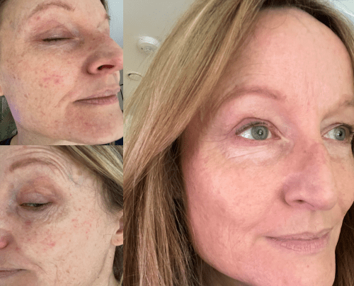 skin and gut health probiotic results